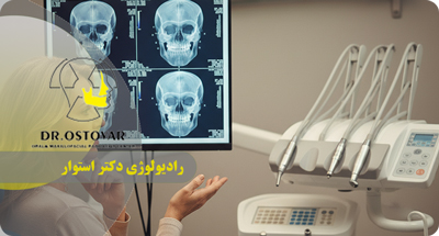 رادیوگرافی سفالومتریک در بندر انزلی | تصاویر جانبی و جلو صورت نزد دکتر فرزانه استوار