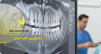 رادیوگرافی مناسب ارتودنسی در بندر انزلی | چه زمانی و چه نوع؟ دکتر فرزانه استوار